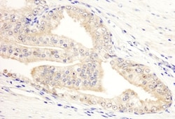 KANK2 Antibody, Novus Biologicals 0.1mg; Unlabeled:Antibodies, Polyclonal