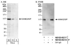 KANK2 Antibody, Novus Biologicals 0.1mg; Unlabeled:Antibodies, Polyclonal