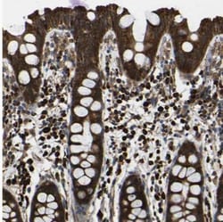 KANK4 Antibody, Novus Biologicals:Antibodies:Primary Antibodies