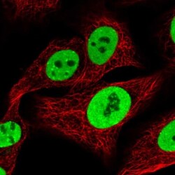 KAP1 Antibody, Novus Biologicals 0.1mL; Unlabeled:Antibodies, Polyclonal