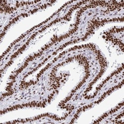 KAP1 Antibody, Novus Biologicals 0.1mL; Unlabeled:Antibodies, Polyclonal
