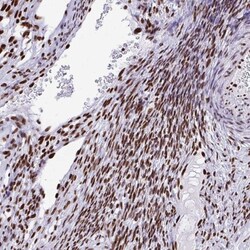 KAP1 Antibody, Novus Biologicals 0.1mL; Unlabeled:Antibodies, Polyclonal
