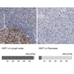 KAT1 Antibody, Novus Biologicals 25 &mu;L; Unlabeled:Antibodies, Polyclonal