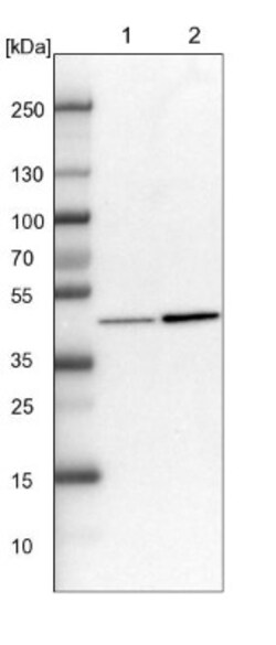 KAT1 Antibody, Novus Biologicals 25 &mu;L; Unlabeled:Antibodies, Polyclonal