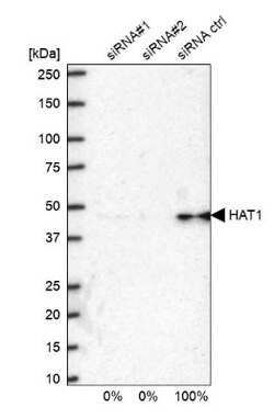 KAT1 Antibody, Novus Biologicals 25 &mu;L; Unlabeled:Antibodies, Polyclonal