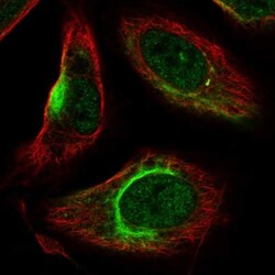 KATNAL2 Antibody, Novus Biologicals:Antibodies:Primary Antibodies