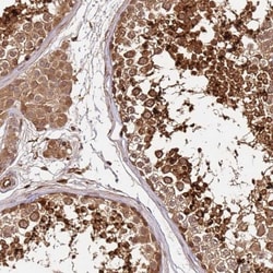 KATNAL2 Antibody, Novus Biologicals:Antibodies:Primary Antibodies