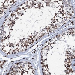 KATNAL2 Antibody, Novus Biologicals 0.1mL; Unlabeled:Antibodies, Polyclonal