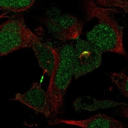 KATNBL1 Antibody, Novus Biologicals:Antibodies:Primary Antibodies