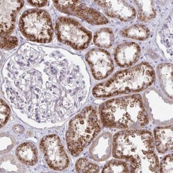 KATNBL1 Antibody, Novus Biologicals:Antibodies:Primary Antibodies