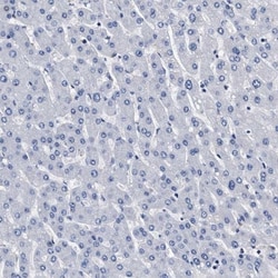 KBTBD10 Antibody, Novus Biologicals:Antibodies:Primary Antibodies