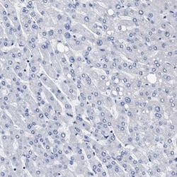 KBTBD10 Antibody, Novus Biologicals:Antibodies:Primary Antibodies