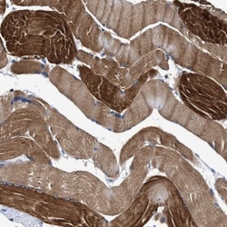 KBTBD10 Antibody, Novus Biologicals:Antibodies:Primary Antibodies