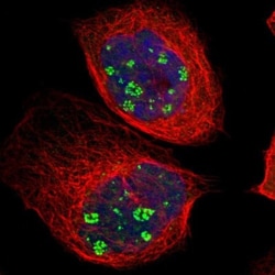 KBTBD2 Antibody, Novus Biologicals 0.1mL; Unlabeled:Antibodies, Polyclonal