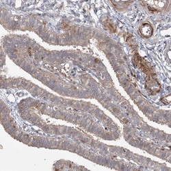 KBTBD4 Antibody, Novus Biologicals:Antibodies:Primary Antibodies