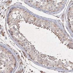 KBTBD4 Antibody, Novus Biologicals:Antibodies:Primary Antibodies