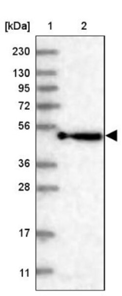 KBTBD4 Antibody, Novus Biologicals:Antibodies:Primary Antibodies