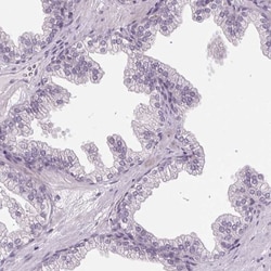 KBTBD5 Antibody, Novus Biologicals 0.1mL; Unlabeled:Antibodies, Polyclonal