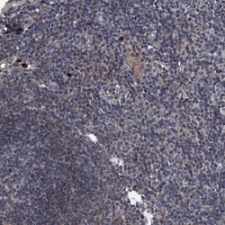 KBTBD8 Antibody, Novus Biologicals:Antibodies:Primary Antibodies