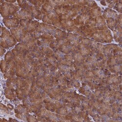 KCC1/SLC12A4 Antibody, Novus Biologicals 0.1mL; Unlabeled:Antibodies, Polyclonal
