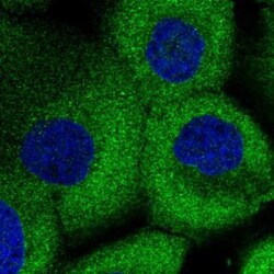 anti-KCMF1, Polyclonal, Novus Biologicals 0.1mL; Unlabeled:Antibodies,