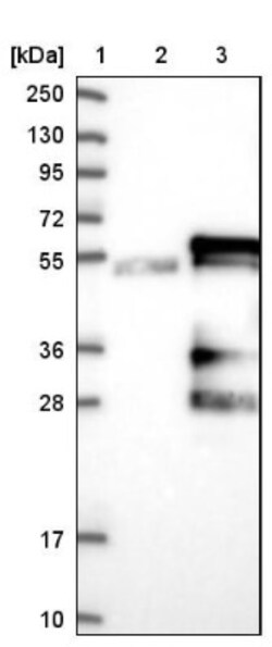 anti-KCMF1, Polyclonal, Novus Biologicals 0.1mL; Unlabeled:Antibodies,