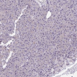 KCNB1 Antibody, Novus Biologicals 25 &mu;L, Unlabeled:Antibodies, Polyclonal
