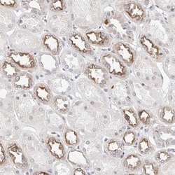 KCNJ1 Antibody, Novus Biologicals:Antibodies:Primary Antibodies