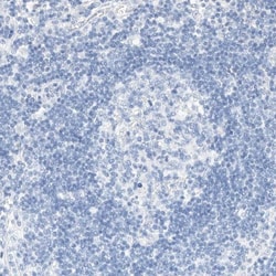 KCNJ1 Antibody, Novus Biologicals:Antibodies:Primary Antibodies