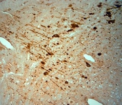 KCNJ10 Antibody, Novus Biologicals:Antibodies:Primary Antibodies