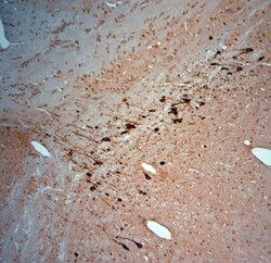 KCNJ10 Antibody, Novus Biologicals:Antibodies:Primary Antibodies