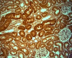 KCNJ10 Antibody, Novus Biologicals:Antibodies:Primary Antibodies