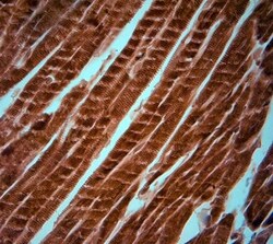 KCNJ10 Antibody, Novus Biologicals:Antibodies:Primary Antibodies