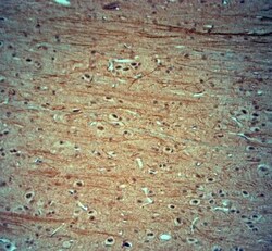 KCNJ10 Antibody, Novus Biologicals:Antibodies:Primary Antibodies