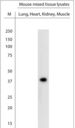KCNJ10 Antibody, Novus Biologicals:Antibodies:Primary Antibodies