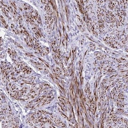 KCNN4 Antibody, Novus Biologicals:Antibodies:Primary Antibodies