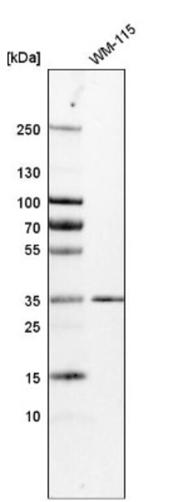 KCTD10 Antibody, Novus Biologicals:Antibodies:Primary Antibodies