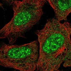 KCTD16 Antibody, Novus Biologicals:Antibodies:Primary Antibodies