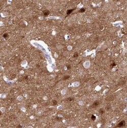 KCTD16 Antibody, Novus Biologicals:Antibodies:Primary Antibodies