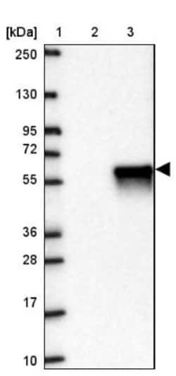 KCTD16 Antibody, Novus Biologicals:Antibodies:Primary Antibodies