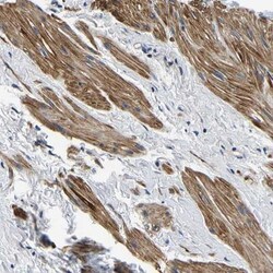 KCTD17 Antibody, Novus Biologicals:Antibodies:Primary Antibodies