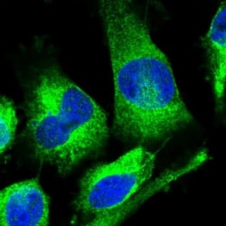 KCTD20 Antibody, Novus Biologicals 0.1mL; Unlabeled:Antibodies, Polyclonal