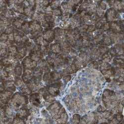 KCTD3 Antibody, Novus Biologicals 0.1mL; Unlabeled:Antibodies, Polyclonal
