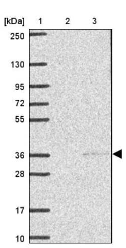 KCTD6 Antibody, Novus Biologicals:Antibodies:Primary Antibodies