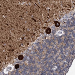 KCTD8 Antibody, Novus Biologicals 25 &mu;L; Unlabeled:Antibodies, Polyclonal