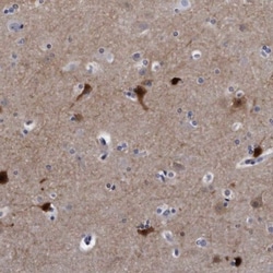 KCTD8 Antibody, Novus Biologicals 25 &mu;L; Unlabeled:Antibodies, Polyclonal