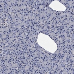 KCTD8 Antibody, Novus Biologicals 25 &mu;L; Unlabeled:Antibodies, Polyclonal