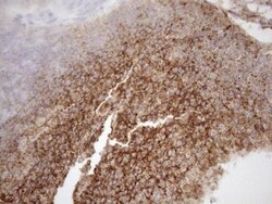 KCTD9 Antibody (OTI2G8), Novus Biologicals 0.1mL; Unlabeled:Antibodies,