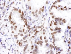 KDM2A/FBXL11 Antibody, Novus Biologicals 0.1 mL | Buy Online | Novus Biologicals | Fisher Scientific