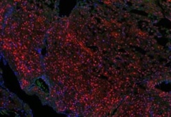 KDM6A Antibody, Novus Biologicals:Antibodies:Primary Antibodies